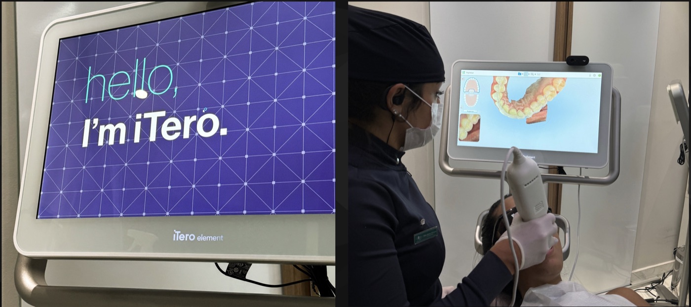 Scanner iTero Lumina - Estúdio Oral